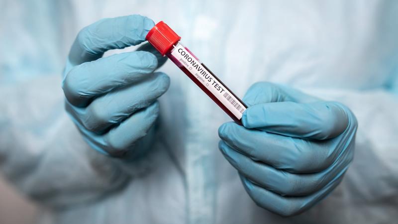 Рост новых случаев заболевания Covid-19 объяснили увеличение объёма тестов на коронавирусную инфекцию