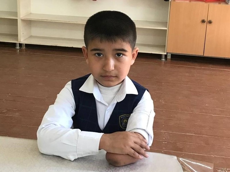 Мираброру нужен протез руки, чтобы продолжать жить активной жизнью